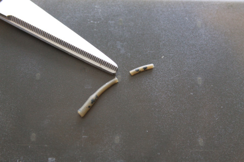 CURVED_LINE_ALIGNERS 3.JPG